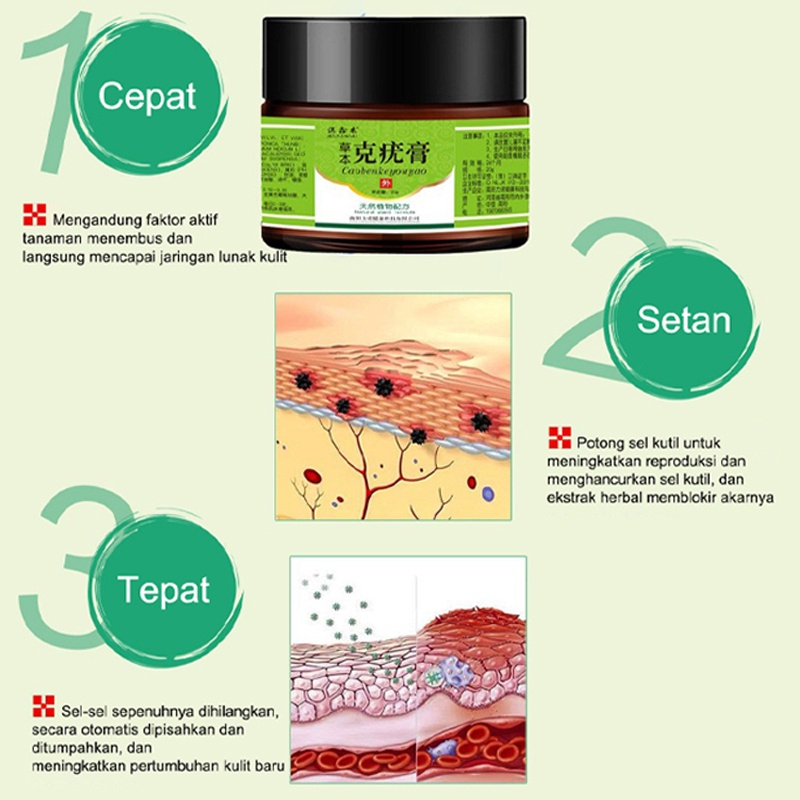 Krim kutil obat penghilang kutil penghilang kutil 20g skin tag remover Menghilangkan kutil, tahi lalat, berbagai skin tag di berbagai bagian tubuh