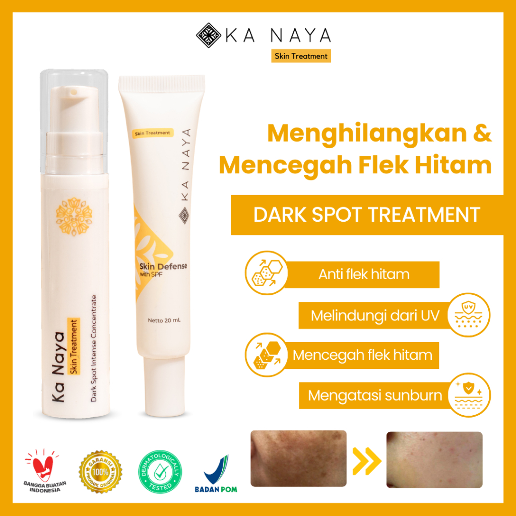 KA NAYA Paket Dark Spot - Krim dan Serum Flek Hitam Membandel untuk Kulit Cerah Glowing