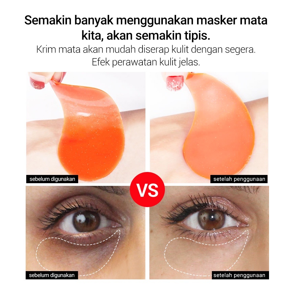 LANBENA Vitamin C Hydrogel Eye Patch Mengurai Melanin Antioksidan Memiliki Penetrasi Yang Kuat Dan Pelembab Yang Cepat Menghilangkan Kantung Mata Lingkaran Hitam Dan Meredakan Gejala Seperti Kulit Di Sekitar Mata