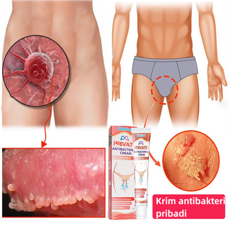 Obat Gatal Selangkangan Salep Gatal Paling Ampuh Kebersihan Kulit Menghilangkan Bau Krim Psoriasis Eczema Anti-Itching Cream selangkangan dan kelamin selangkangan dan kelamin Anti jamur obat panu kadas Salep Obat Jamur Kulit kadas selangkangan