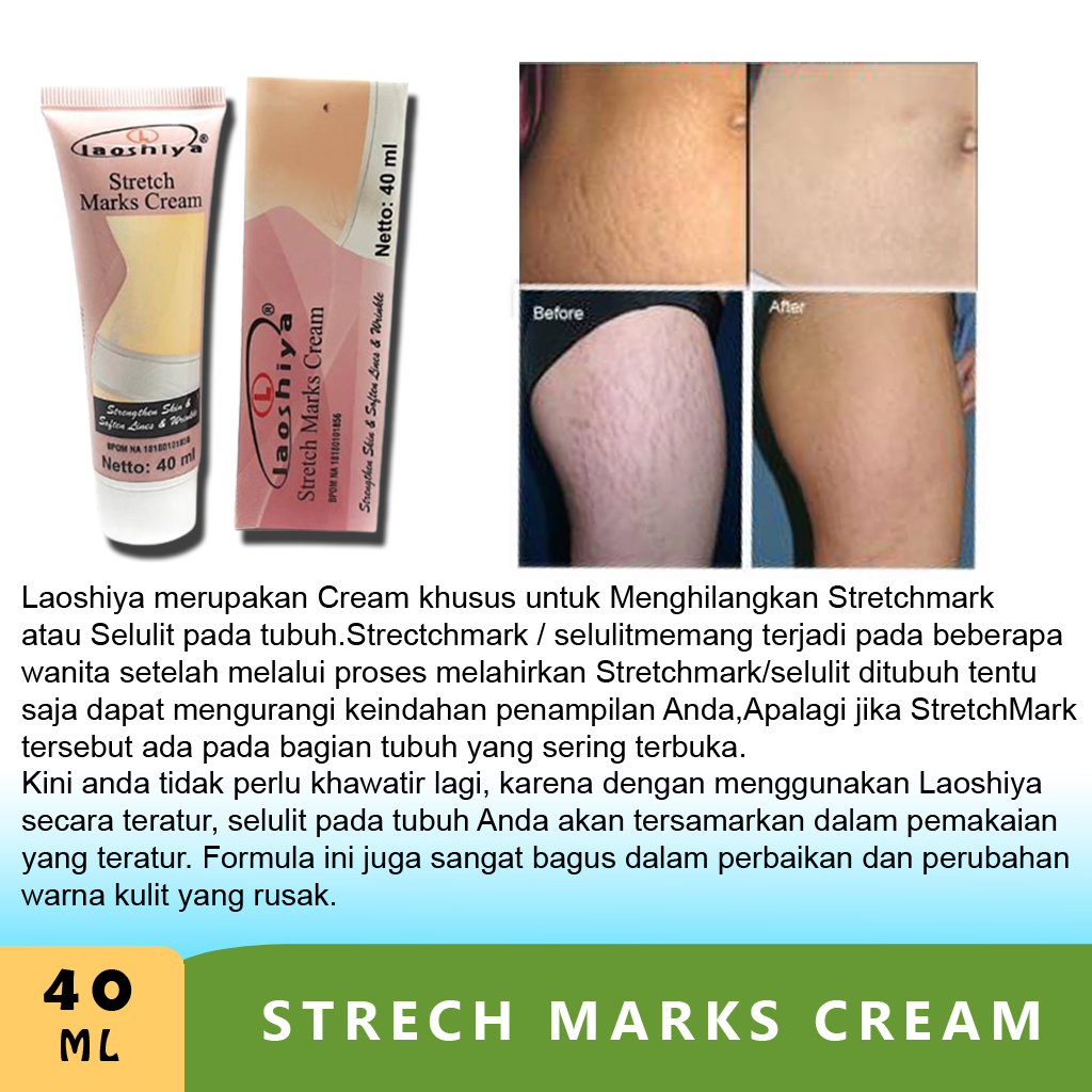 Cream obat Penghilang strechmark stretch mark cream paling ampuh BPOM