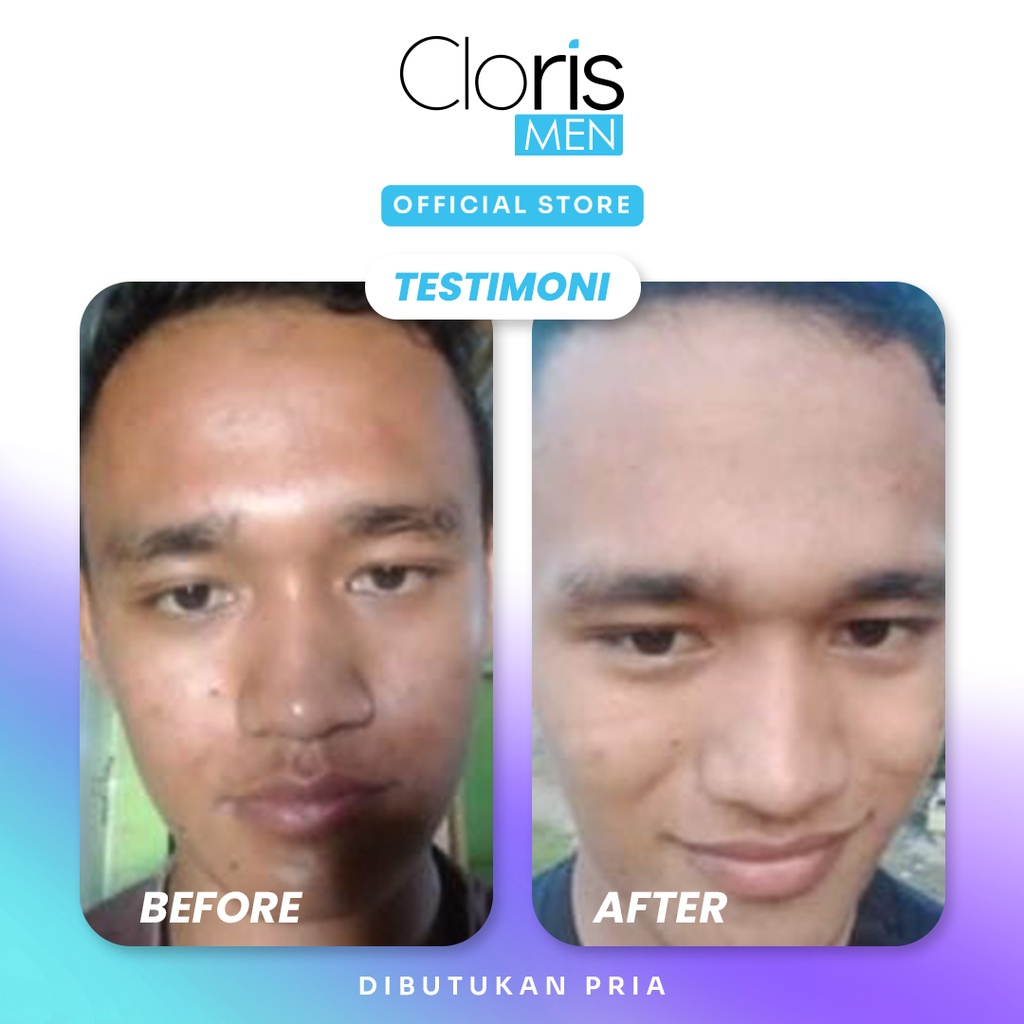 Clorismen Brightening Series Paket Skincare Pria Pemutih Wajah