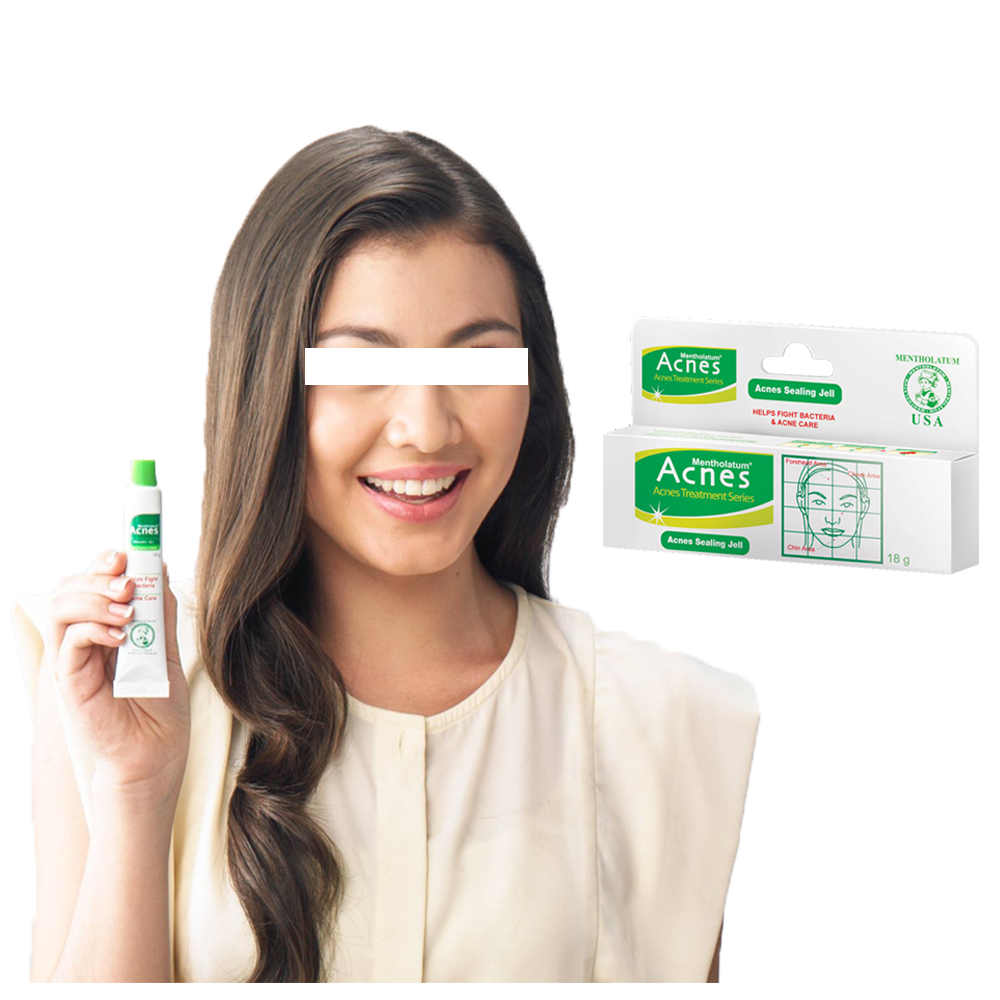 Acnes Sealing Jell 9gr & 18gr BPOM 100% Original Skincare Perawatan Wajah Jerawat Cream Pengangkat S