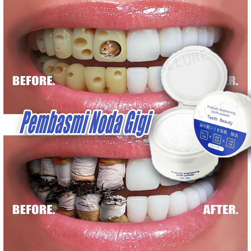 IUALLURE Odol pemutih gigi dan karang gigi Pemutih gigi Permanen teeth whitening Pemutih gigi dan pe