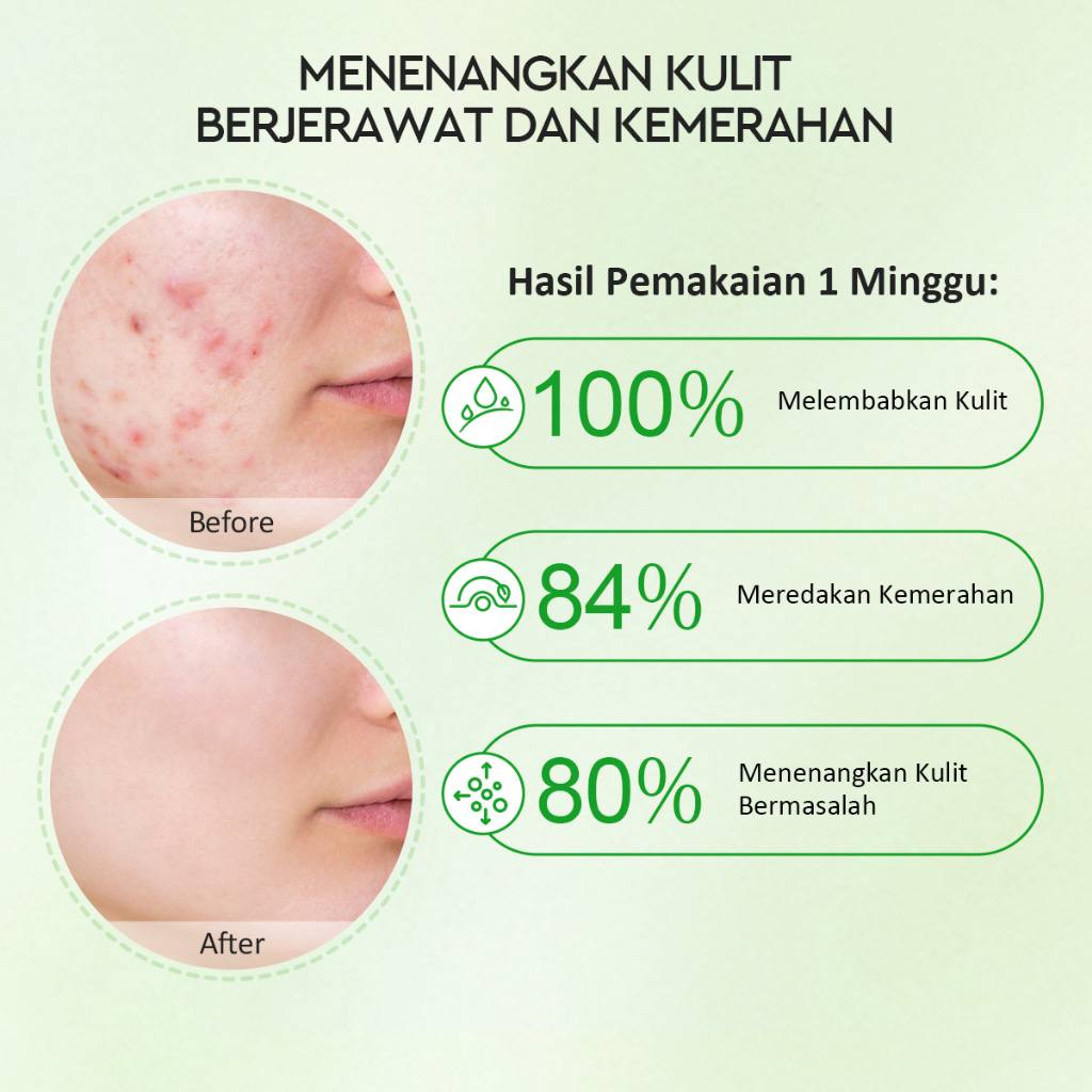 [MS][BPOM] GLAD2GLOW BLUEBERRY MOISTURIZER 5% CERAMIDE | CENTELLA ALLANTOIN MOISTURIZER