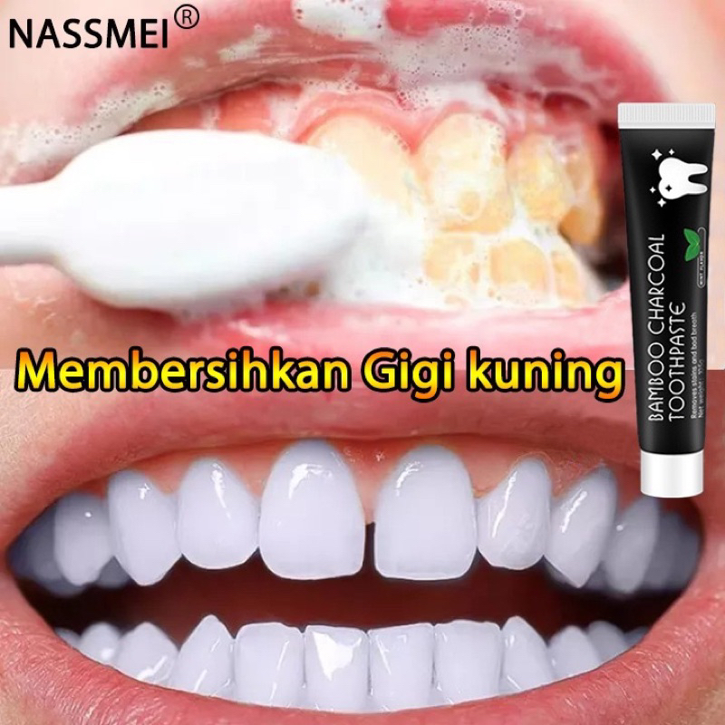 pasta gigi pemutih / memutihkan gigi kuning