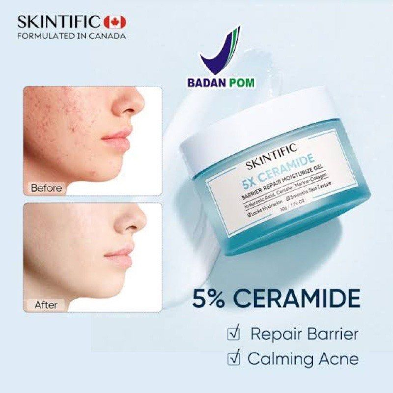 Skintific Moisturizer Gel Mini Series 30G 5X Ceramide / Niacinamide Brightening (Bisa Cod)