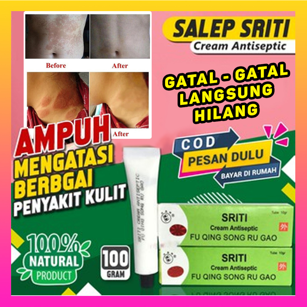 SALEP SRITI / CREAM ANTISEPTIK / SALEP GATAL-GATAL / KURAP / KUDIS / PANU / JAMUR