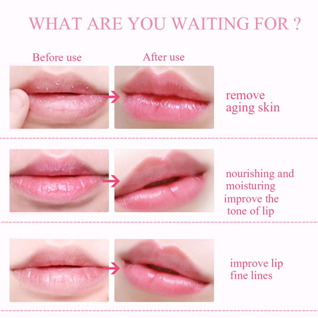 Cherry Lip Mask Masker Bibir Vitamin Pelembab Skincare Masker Bibir Collagen