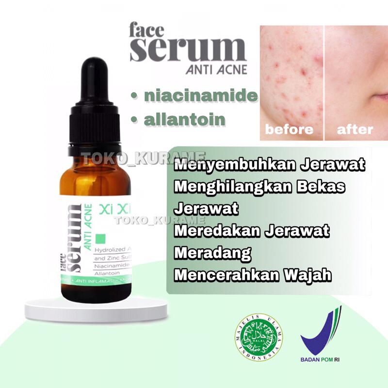 SERUM ANTI ACNE - Jerawat.Bekas Jerawat. (xiu)