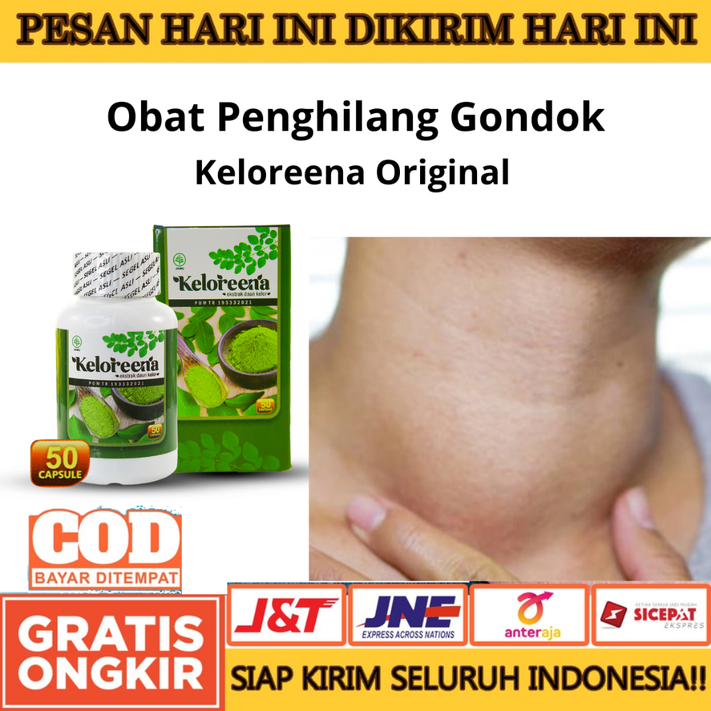 Keloreena Obat Pengempis Dan Penghilang Gondok, Gondok Di Leher, Gondok Beracun, Gondongan, Leher Be