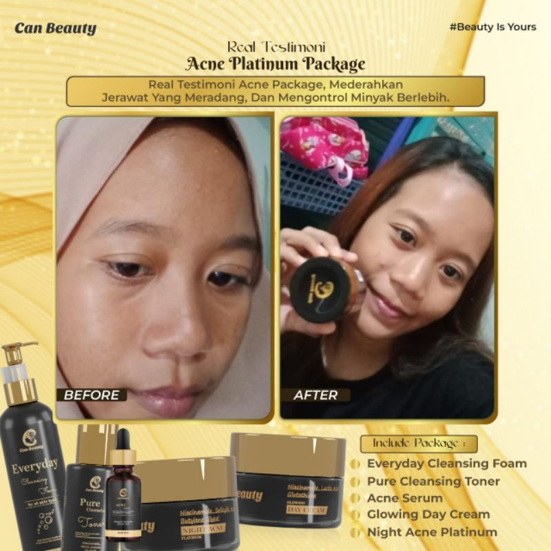 𝗖𝗮𝗻 𝗕𝗲𝗮𝘂𝘁𝘆 𝗦𝗸𝗶𝗻𝗰𝗮𝗿𝗲 𝗕𝗣𝗢𝗠 Canbeauty Official Paket Whitening Platinum Glowing