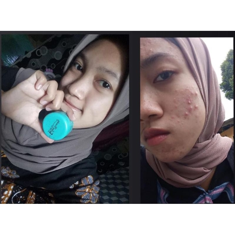 ELIZA BAUTY CREAM SIANG MALAM