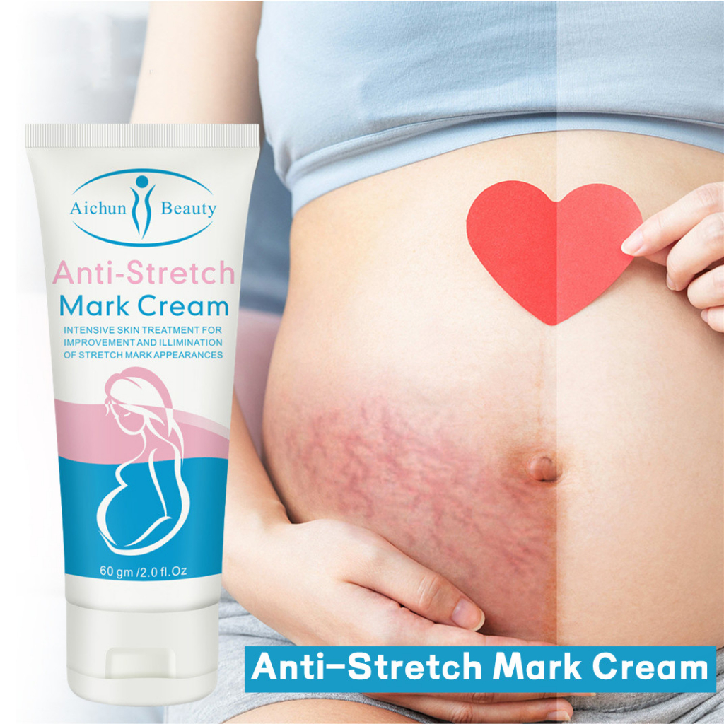 Stretch Mark Cream Anti- Stretch Mark Cream Krim Penghilang Strechmark Pasca Melahirkan Penghilang Bekas Luka 60g [100% Original]