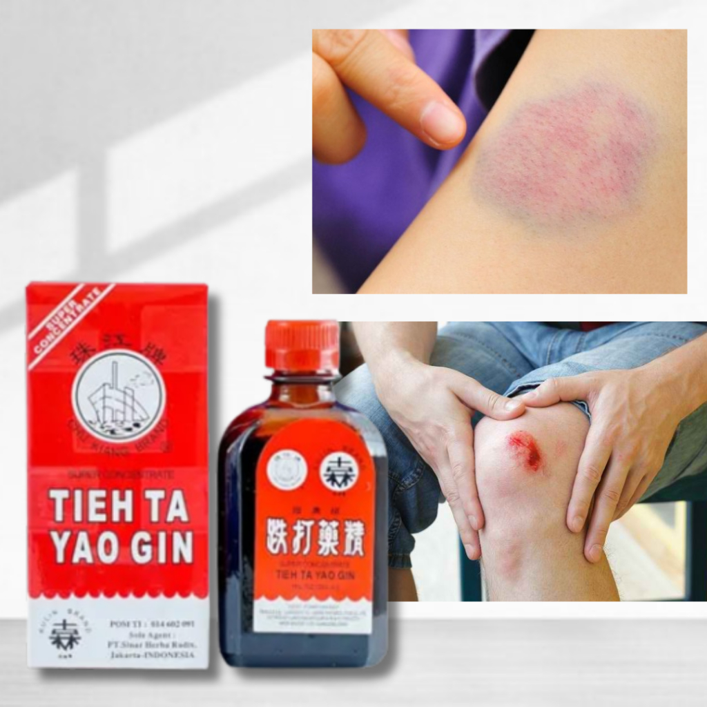 betadin cair penyembuh luka memar memerah,obat merah untuk menyembuhkan luka memar berdarah luka lec