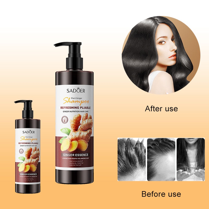 Red Ginseng Hair Tonic Rambut Rontok Parah Vitamin Rambut Mengatasi Kebotakan Dan Melangsang Pertumbuhan Rambut Baru