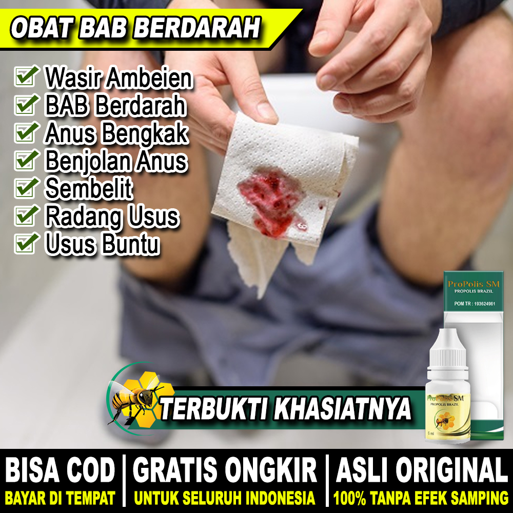 Obat Wasir Ambeien Obat BAB Berdarah Obat Infeksi Radang Usus Obat Usus Buntu Obat Anus Bengkak Obat