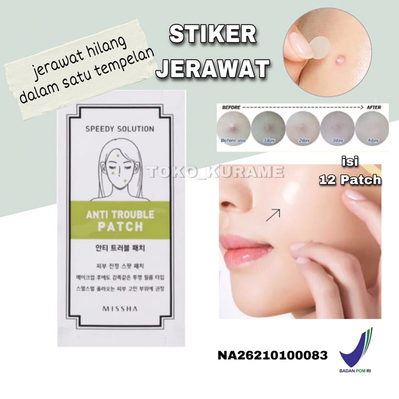 [BPOM] ACNE PATCH BY MISSHA ISI 12PATCH OBAT JERAWAT PATCH JERAWAT OBAT TOTOL JERAWAT STIKER JERAWAT ACNE SPOT TREATMENT JERAWAT OBAT TOTOL JERAWAT PENUTUP JERAWAT PENGEMPES JERAWAT TEMPELAN JERAWAT MASKER JERAWAT