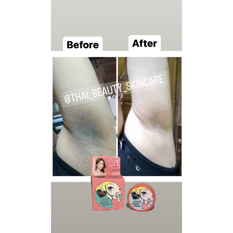 I-DOLL PEMUTIH KETIAK ORI THAILAND