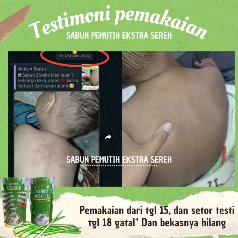 Sabun pemutih exstra sereh original 100%