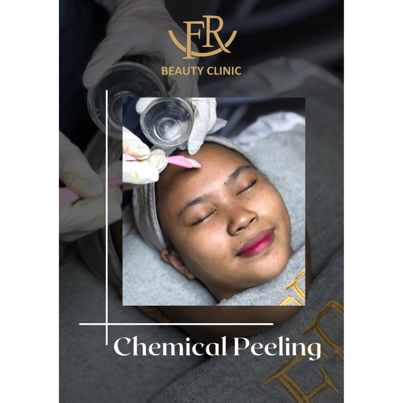 Paket Chemical Peeling Wajah
