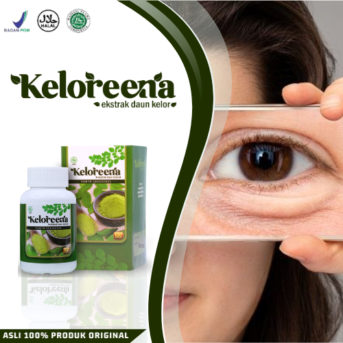 Obat Mata Kendur, Obat Kantung Mata Kendur, Kelopak Mata Kendur, Kurang Tidur, Obat Kelopak Mata Ben