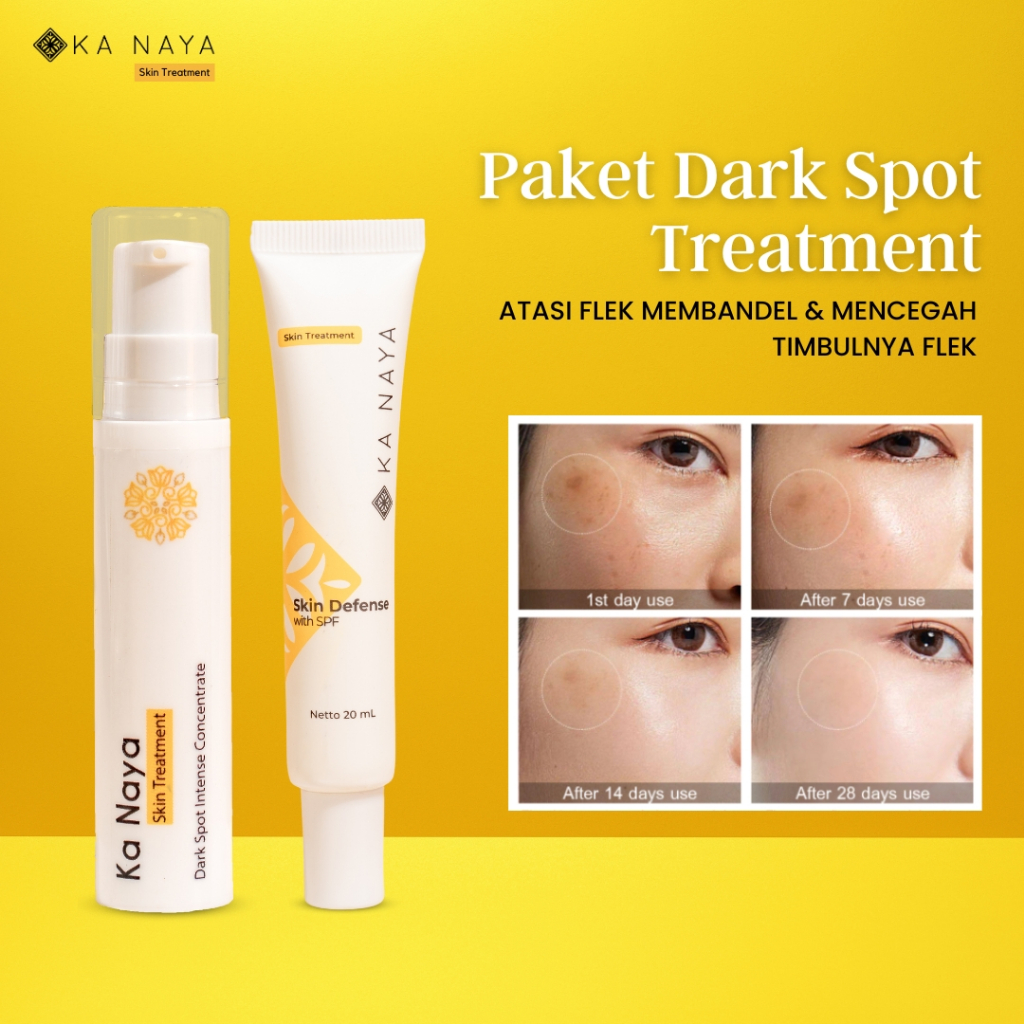 Ka Naya PAKET Dark Spot - Obat Bekas Jerawat - Salep Flek Hitam Membandel - Cream Penghilang Flek Hi