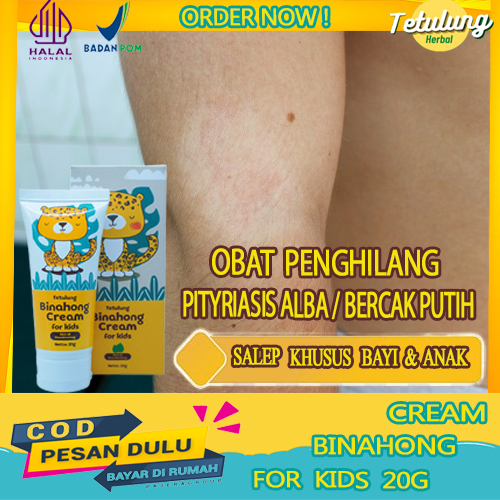 Binahong Cream Kids Salep Pityriasis Alba Anak, Penghilang Bercak Putih diwajah Badan, Obat Oles Amp