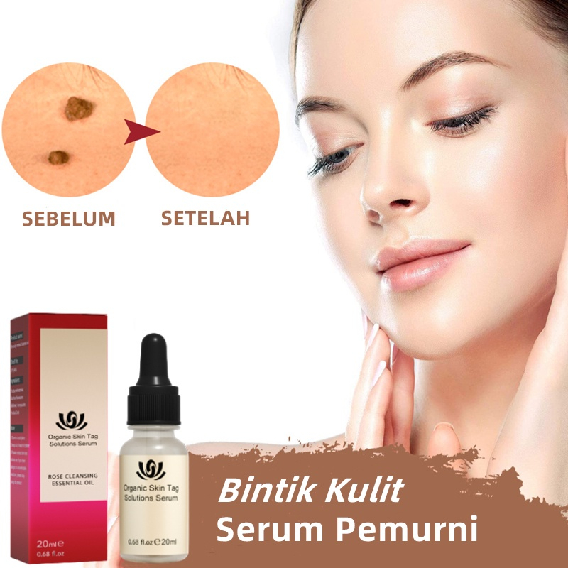 Wart Removal Cream Repair And Clean Skin Tag Papilloma Remover 20g - Menghilangkan Kutil Tahi Lalat Mata Ikan Menghilangkan Kutil Tahi Lalat Mata Ikan Wart Remover - Salep Obat Penghilang Tahi Lalat dan Kutil