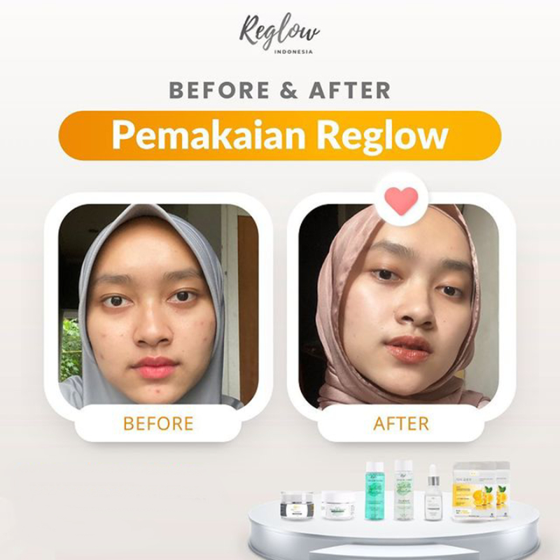 REGLOW SKINCARE ORIGINAL DR. SHINDY DOCTOR RE GLOW BEAUTY SKINCARE 100% BPOM UNTUK FLEK OFFICIAL STORE