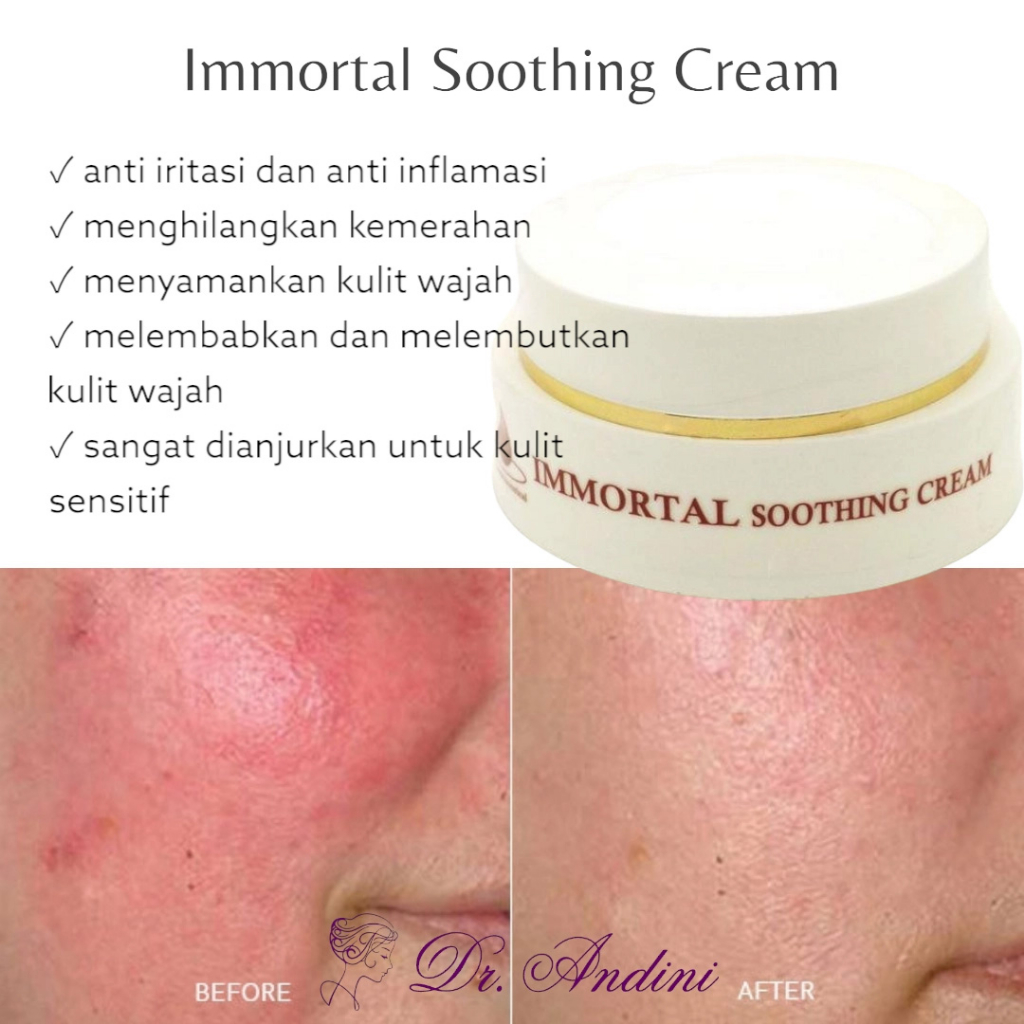 IMMORTAL CREAM ANTI IRITASI SOOTHING CREAM MENCEGAH IRITASI DAN MENYAMANKAN KULIT WAJAH