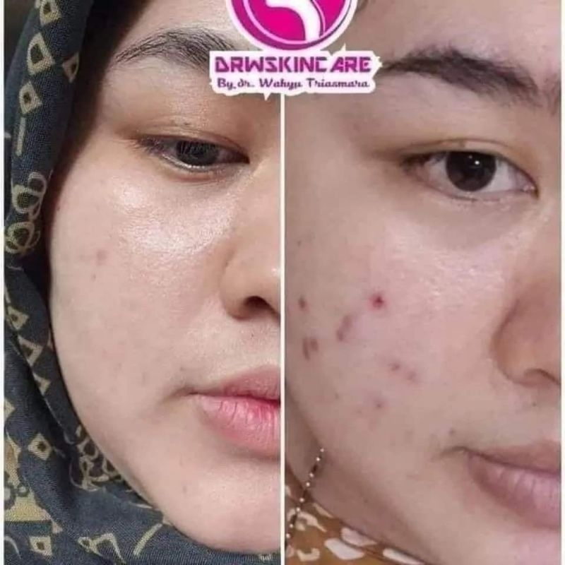 cream malam drw Skincare