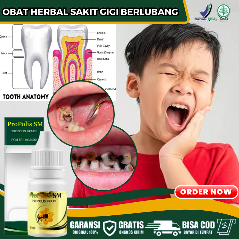 Obat Alami Sakit Gigi Untuk Anak Usia 3 Tahun ke Atas, Pengempis Benjolan di Gusi, Atasi Gusi Bengka
