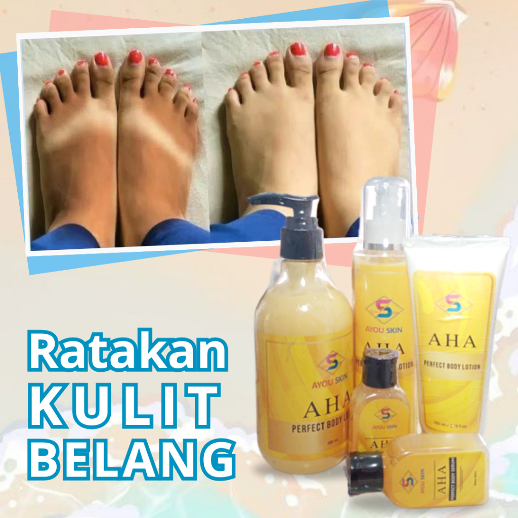 Cream Krim Pencerah Kaki Belang Bekas Sandal Sendal Untuk Pria dan Wanita - Pemutih Kaki Belang AHA 
