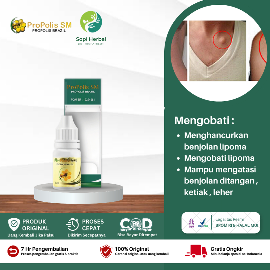 Obat Penghilang Benjolan Di Leher, Penghancur Benjolan di Tangan, Ketiak, Obat Penghilang Benjolan L