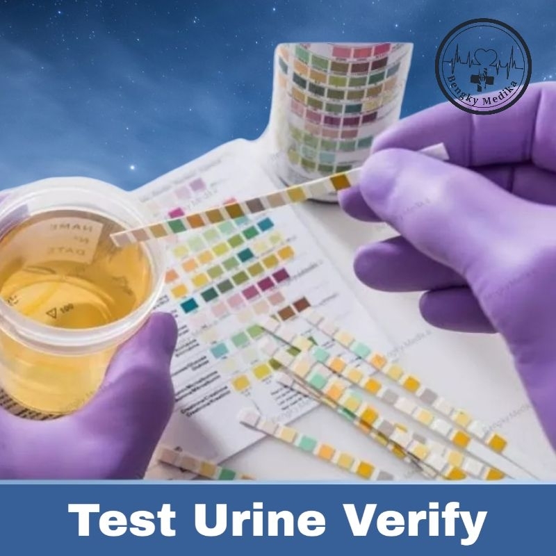 Verify Test Urine 10 Parameter  Verify 3 Parameter
