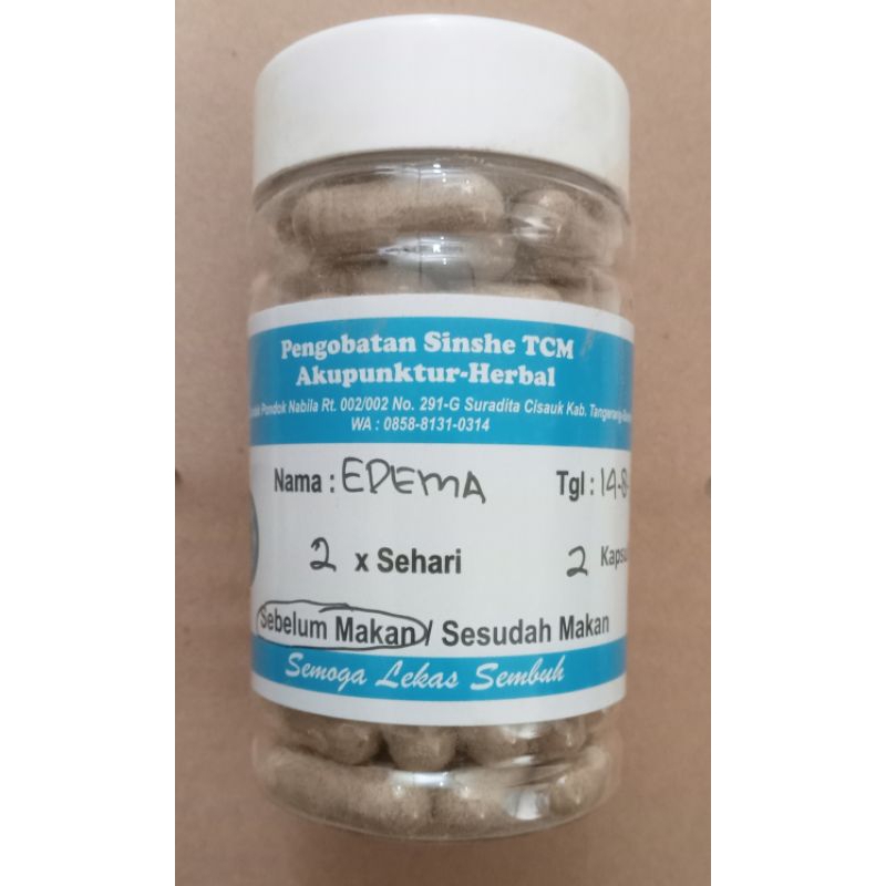 

Bengkak Edema type Bak Lancar