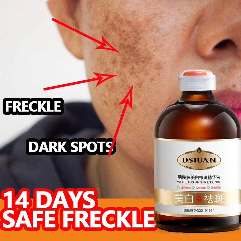 Penghilang flek hitam di wajah Serum Pemutih wajah sabun pemutih wajah Night whitening salep flek hi