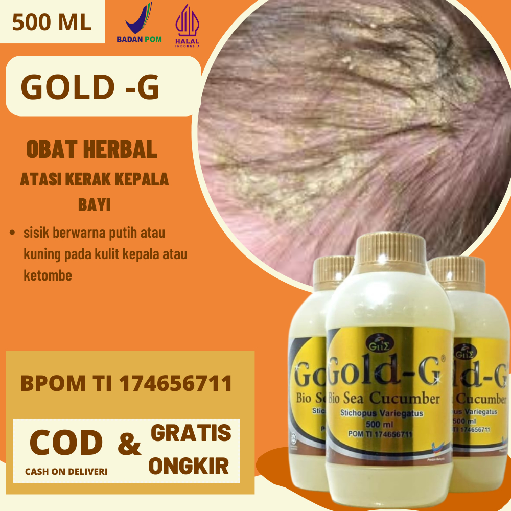 obat oles penghilang kerak kepala pada bayi pembersih kulit kepala bayi kepala bersisik obat Herbal 