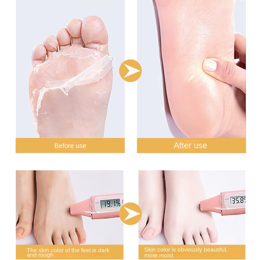 1Pair Niacinamide Hand Mask Moisturizing Gloves Whitening Hand Mask Exfoliating Remove Dead Skin Nourishing Hand Scrub