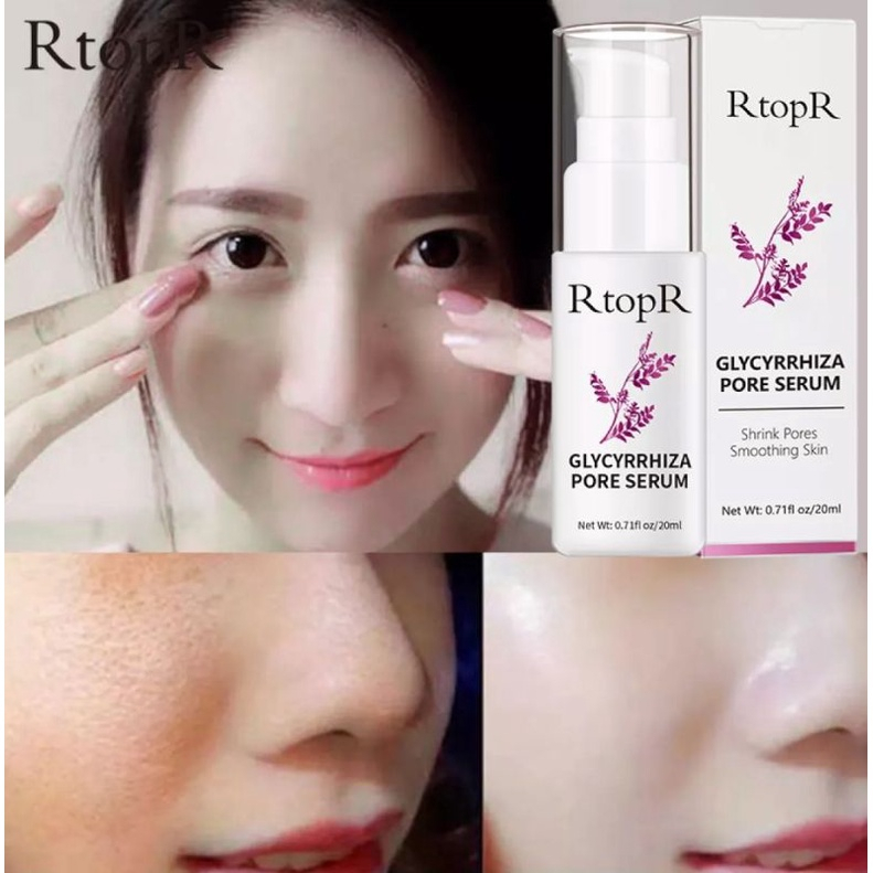 RTOPR GLYCYRRHIZA FACE PORE COLLAGEN