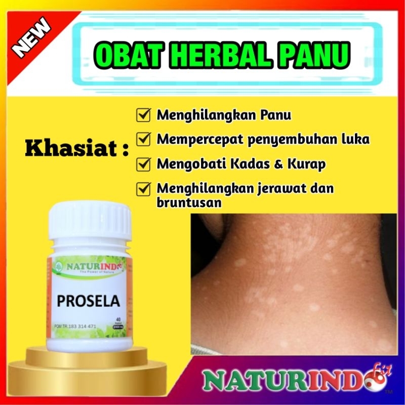 Obat Penghilang Panu Obat Panu Paling Ampuh Obat Panu Kadas Kurap Ampuh Naturindo
