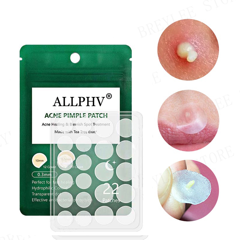 [Ori100%]ALLPHV Acne Pimple Patch/acne patches -Paket Sticker Jerawat Day (0.1mm) &amp; Night (0.3mm)