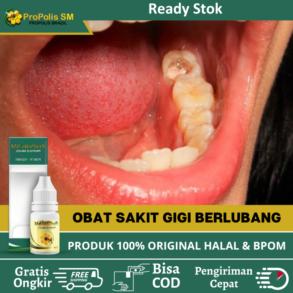 Obat Sakit Gigi Berlubang, Sakit Gigi Dan Gusi, Gigi Nyut Nyutan, Sakit Gigi Linu, Sakit Gigi Kropok