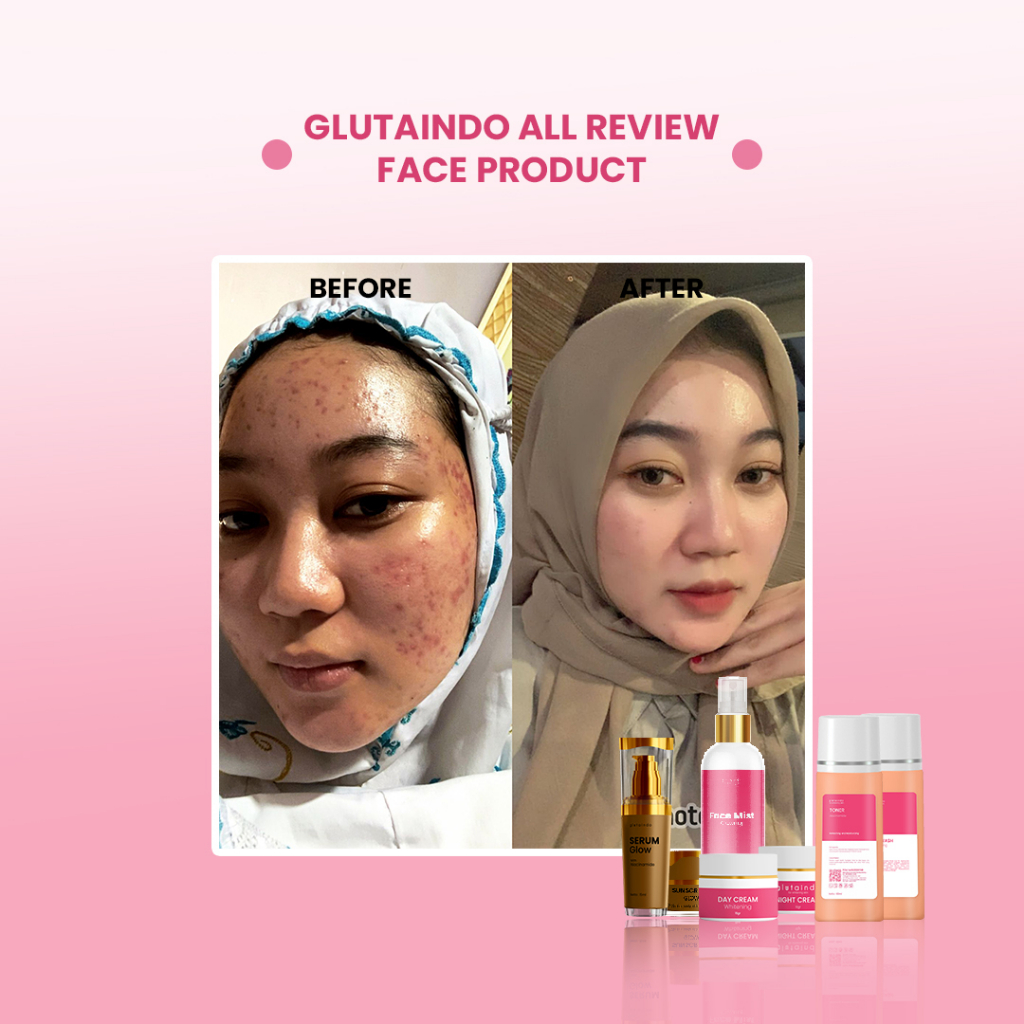 Glutaindo Face Serum Glowing Untuk Mencerahkan Dan Memperbaiki Skin Barrier