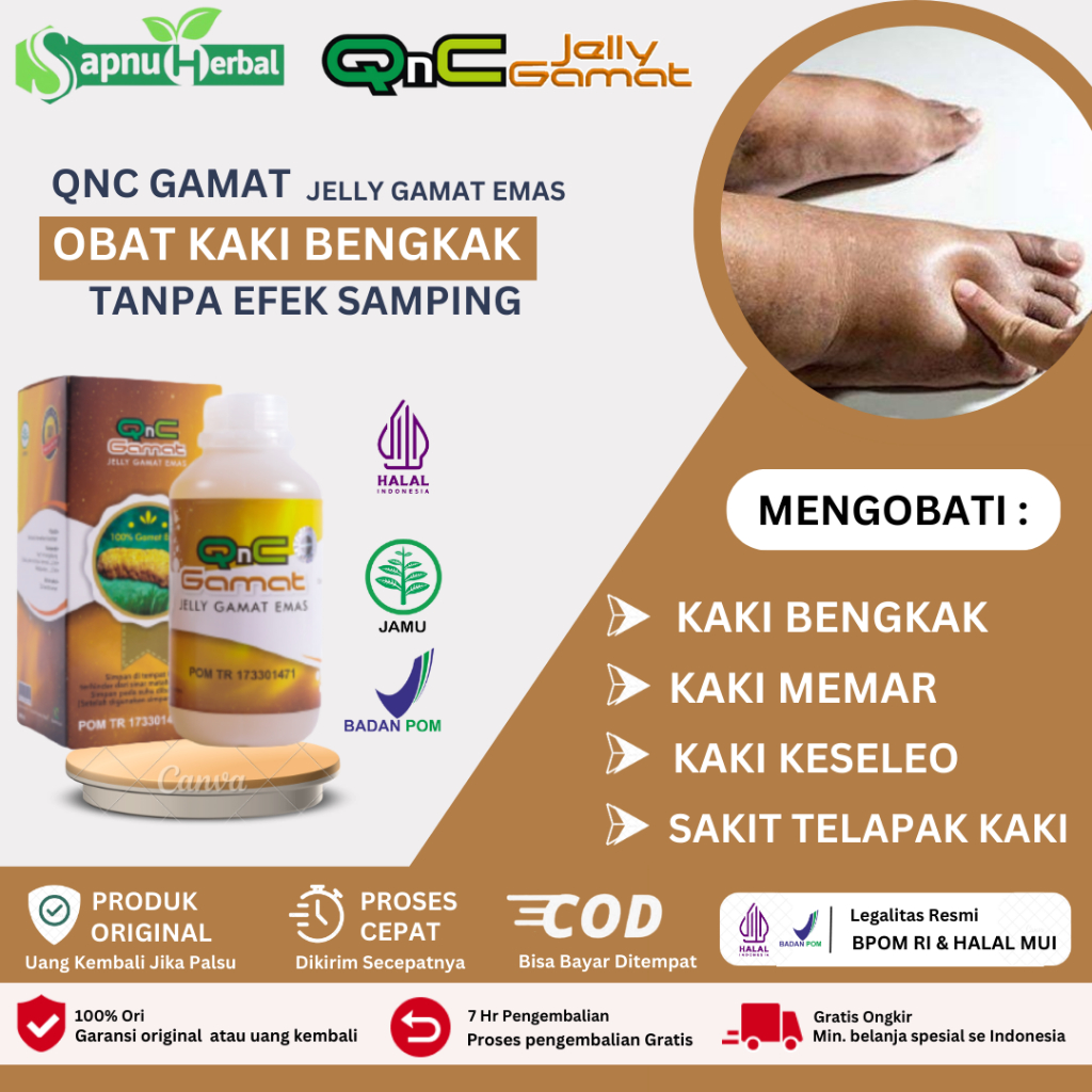 Obat Kaki Bengkak, Kaki Bengkak dan Nyeri, Kaki Bengkak Ibu Hamil, Kaki Bengkak Karena Jatuh, Sakit 