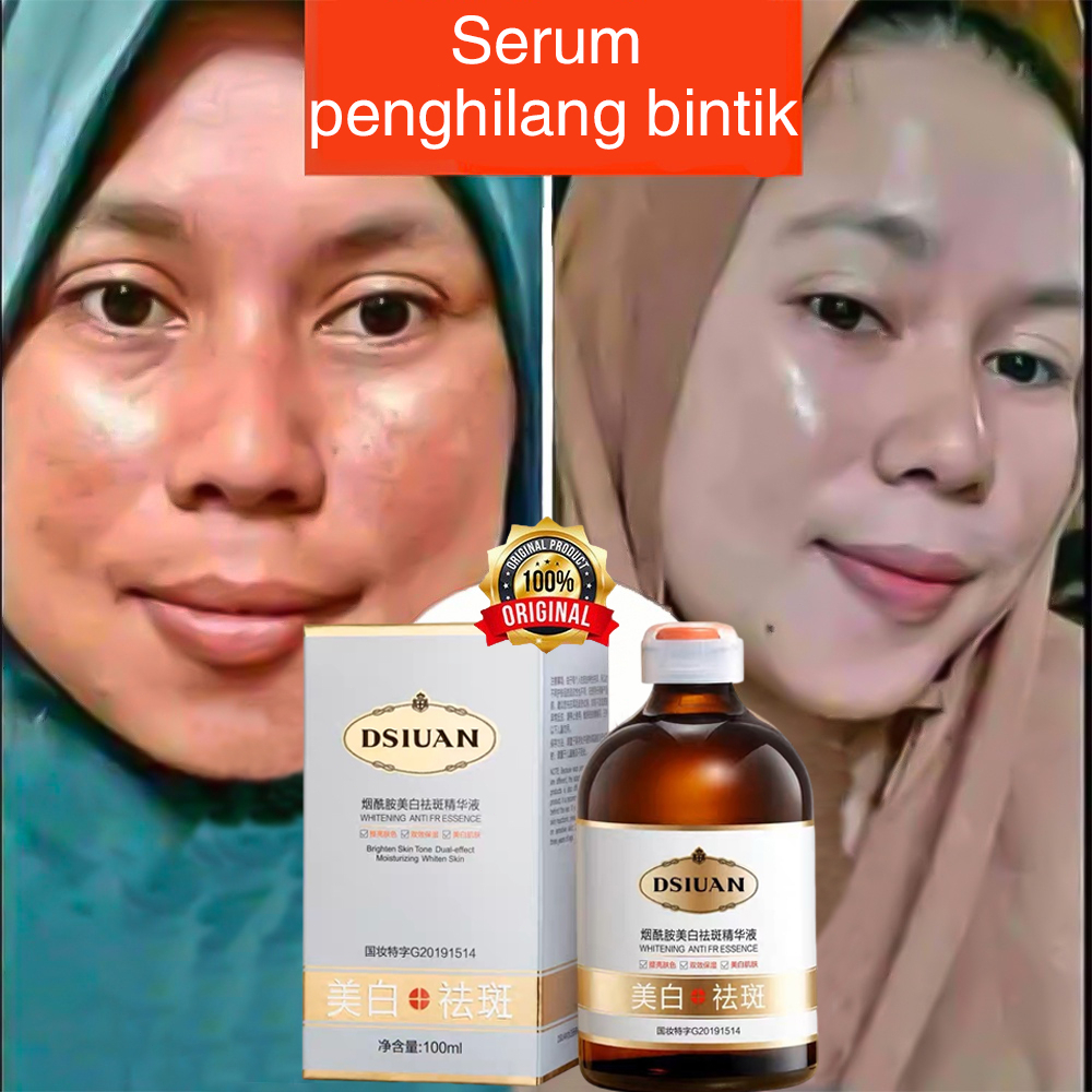 Serum flek hitam Serum flek Serum penghilang flek hitam 100ml Serum bintik ampuh/Serum pemutih binti