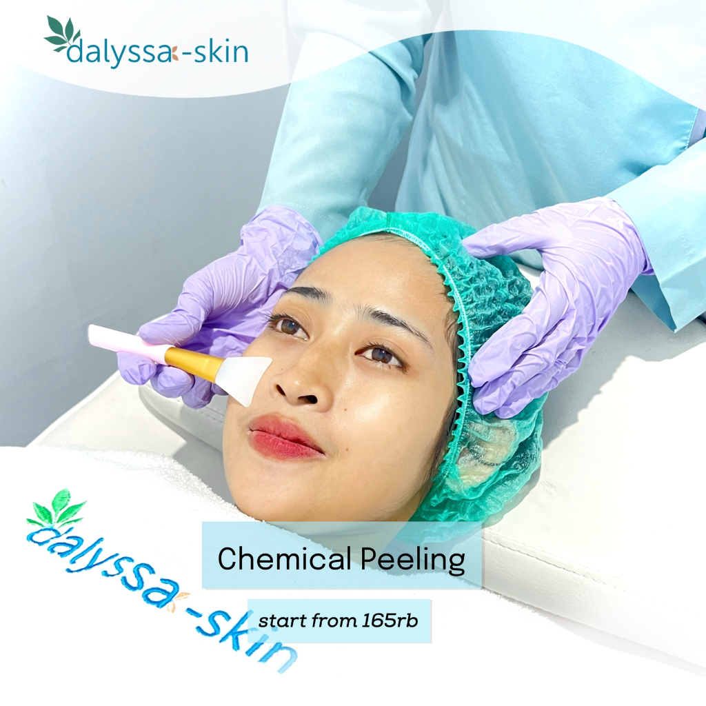 Chemical Peeling