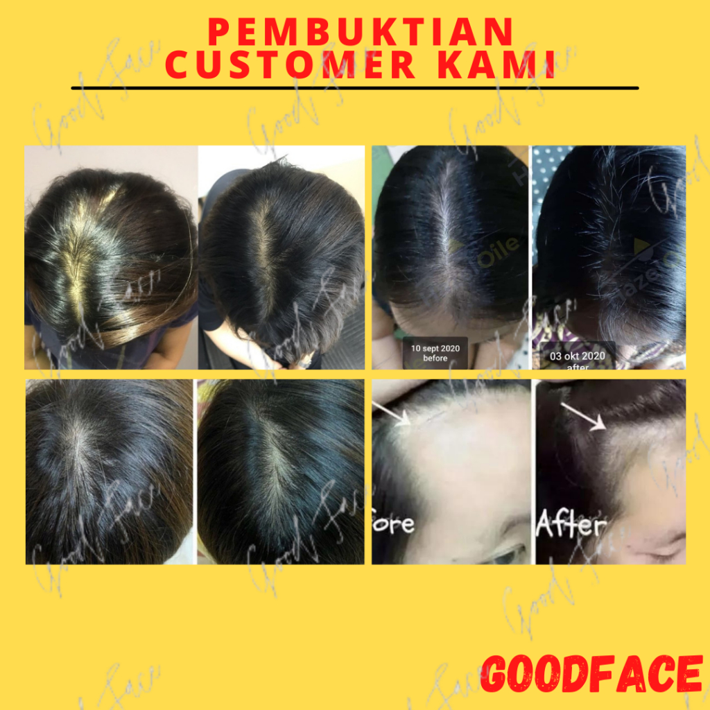 BIO HERBAL HAIR TONIC PERAWATAN RAMBUT RONTOK TREATMENT RAMBUT PERAWATAN RAMBUT KERING