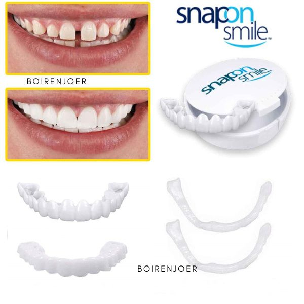[ORIGINAL] Snap On Smile Gigi Palsu 1 Set Atas Bawah / Gigi Palsu Venner Instan Pemutih Gigi Snap On